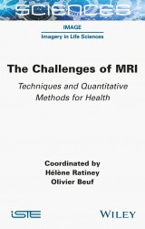 The Challenges of MRI